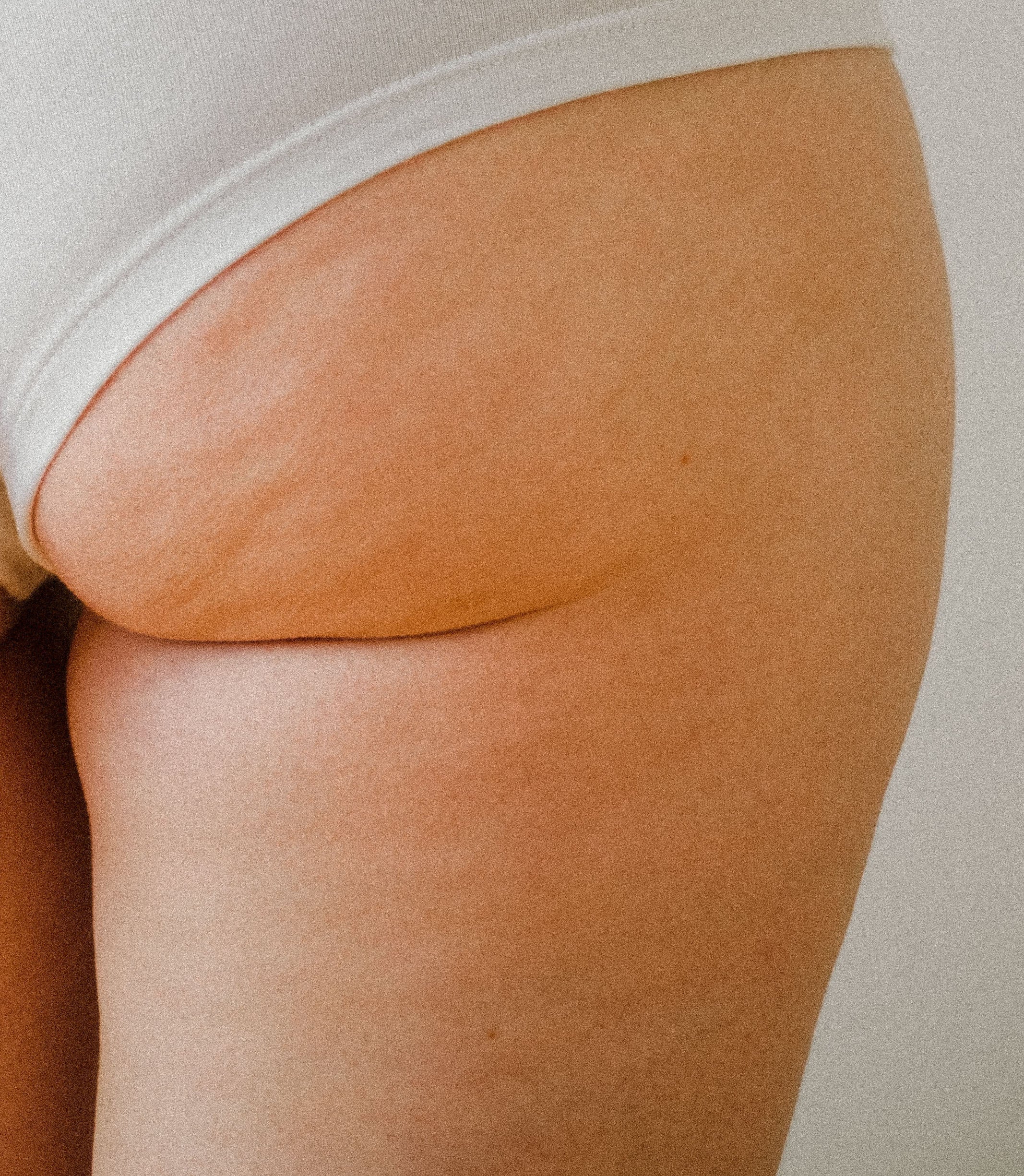It's Time to Embrace Cellulite – Move With Us